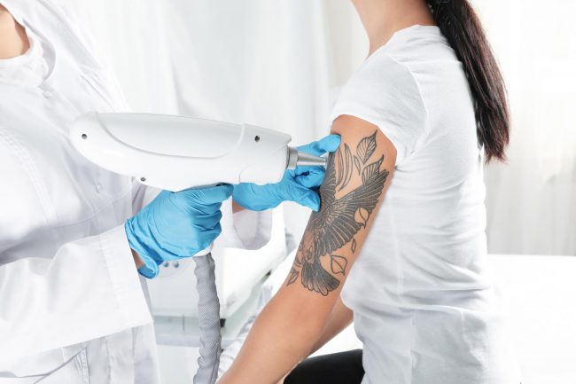 Aqua Beauty - Tattoo Removal Treatment